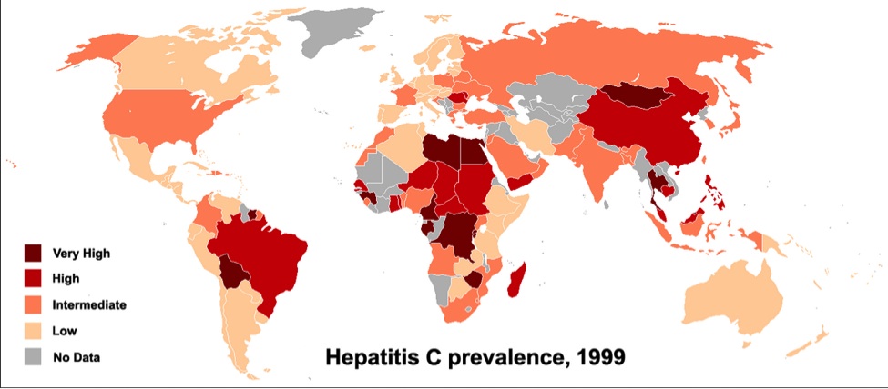 By PhilippN WHO Guide Hepatitis C 2002map based on http://commons.wikimedia.org/wiki/Image:BlankMap‐World.png, CC BY‐SA 3.0, https://commons.wikimedia.org/w/index.php?curid=2127175